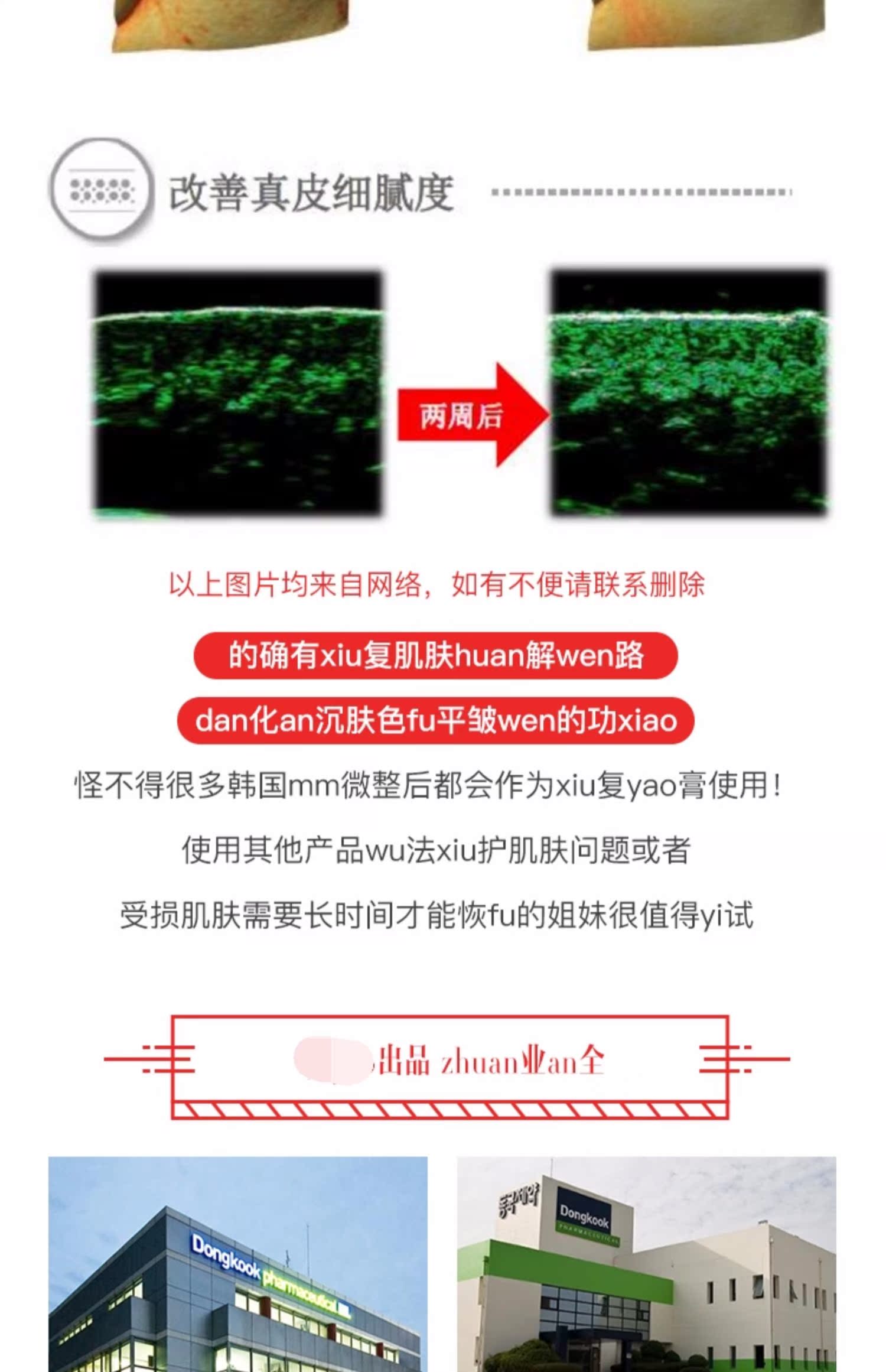 Lớn lên ở Hàn Quốc Đông Khang Dược phẩm Centellian24 Center Lotus Snow Cover Cream Repair dưỡng ẩm - Kem dưỡng da kem dưỡng da cho da dầu