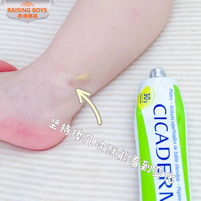 French calendula anti-itch cream Calendula multi-effect repair cream baby children mosquito bite anti-itch cream soothing