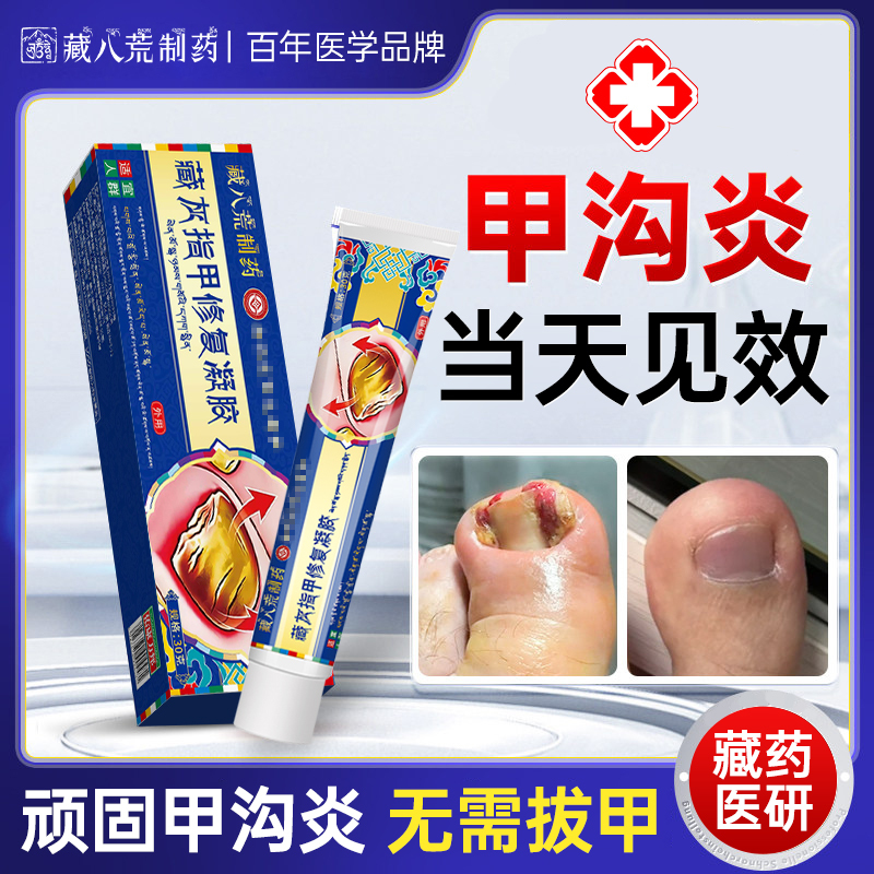 The Number One Effective Medicine for Treating Paronychia, the Special Medicine for Treating Black Nails, the Medicine Specifically for Toenails Growing into the Flesh, the Special Medicine for Softening Big Toe Nail Groove Inflammation