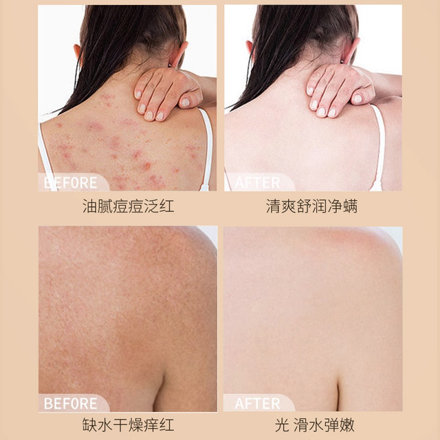 Sulfur Liquid Soap Shower Gel Cleansing Milk Shampoo to Remove Mites Men and Women Face Acne Shanghai Soap