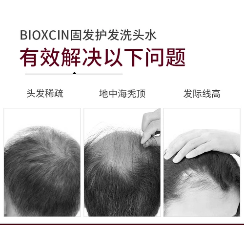 Турецкое шампунь биоксцин мыть и выпадение волос 8 раз способствует сырым волосам биокссин оригинал 300м