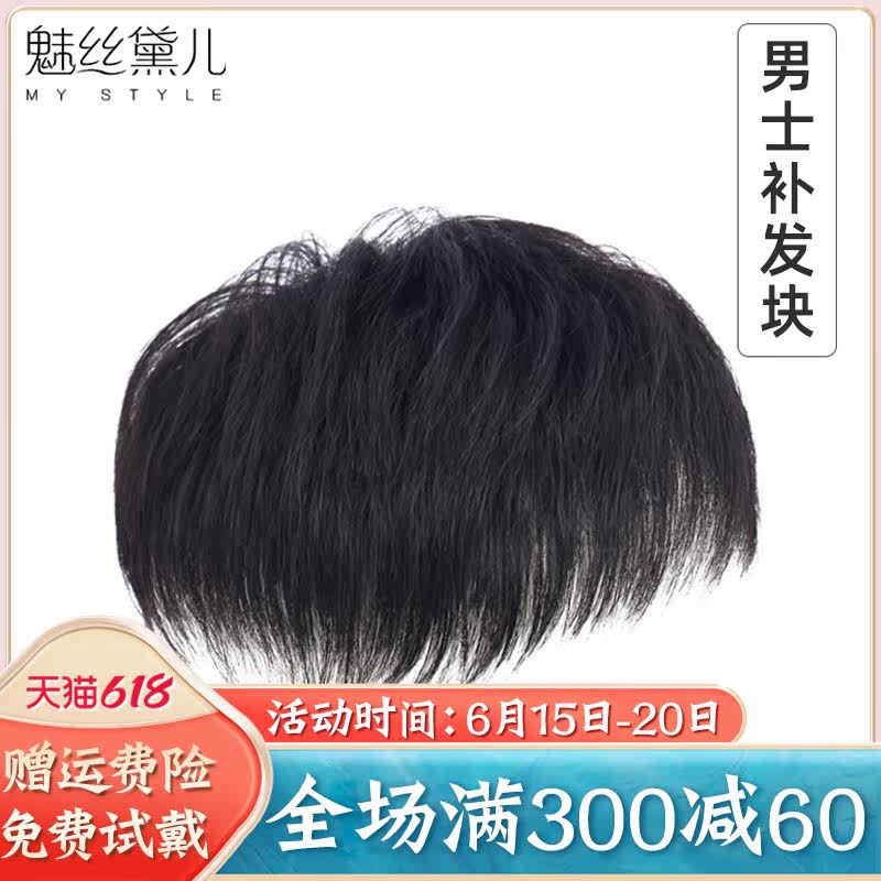 Men's wig Men's short haircut Han version Wig Pieces Head Top Patch Hair patch Forehead Tonic Hair Bald Hair bald Wig Condom
