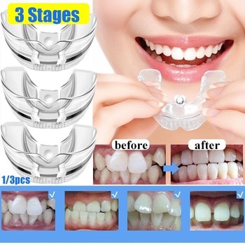 3 stages dental orthodontic teeth silicone braces appliance