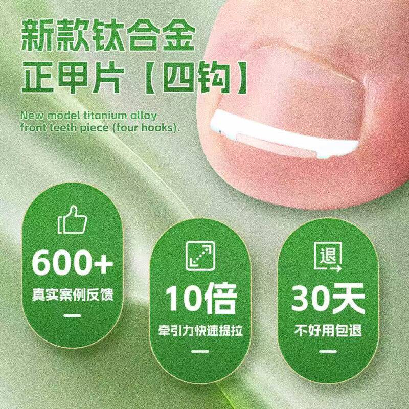 New Ingrown Toenail Corrector, Ingrown Nail Correction, Nail Groove Inflammation Auxiliary Tool, Nail Straightening Tool, Nail Curling Tool