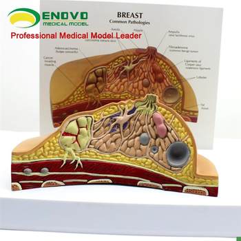 Yino genuine breast pathological anatomy model x breast model obstetrics and gynecology teaching nursing breast model