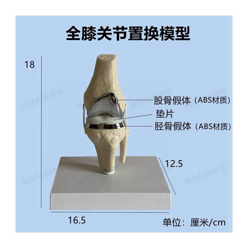 Knee Joint Artificial Prosthetic Model Meniscus Cartilage Surgery Demonstration Single-Joint Total Knee Replacement Demonstration Medical