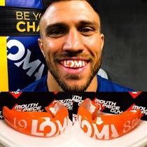 Mouthguard customization