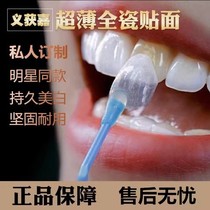 Ivoca all-ceramic dental veneers imported blue porcelain amber porcelain Lingxi porcelain ultra-thin dental veneers private customized dental veneers