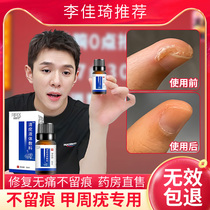 A special medicine for warts around the nail