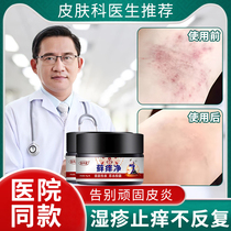 Eczema itching root topical stubborn dermatitis mosquito bites ointment dermatitis allergy special medicine antibacterial and swelling