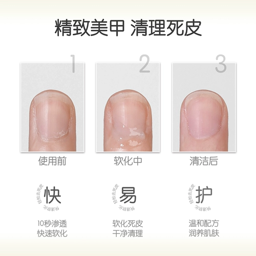 Отшелушивающее средство для смягчения ороговевшей кожи для маникюра, питательное масло, профессиональный набор маникюрных инструментов для ногтей, лечебное масло для пальцев