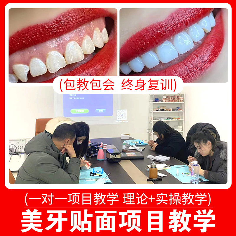 オールセラミック歯科用ベニア技術の学習、歯のホワイトニングベニアの指導、歯科用ポーセレンベニアのトレーニング、樹脂のトレーニング、歯科用ベニアメーカー