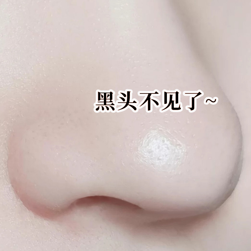 Red recommends deep cleaning mask coated mud membrane to black head oil contraction pores and small white mud replenishment