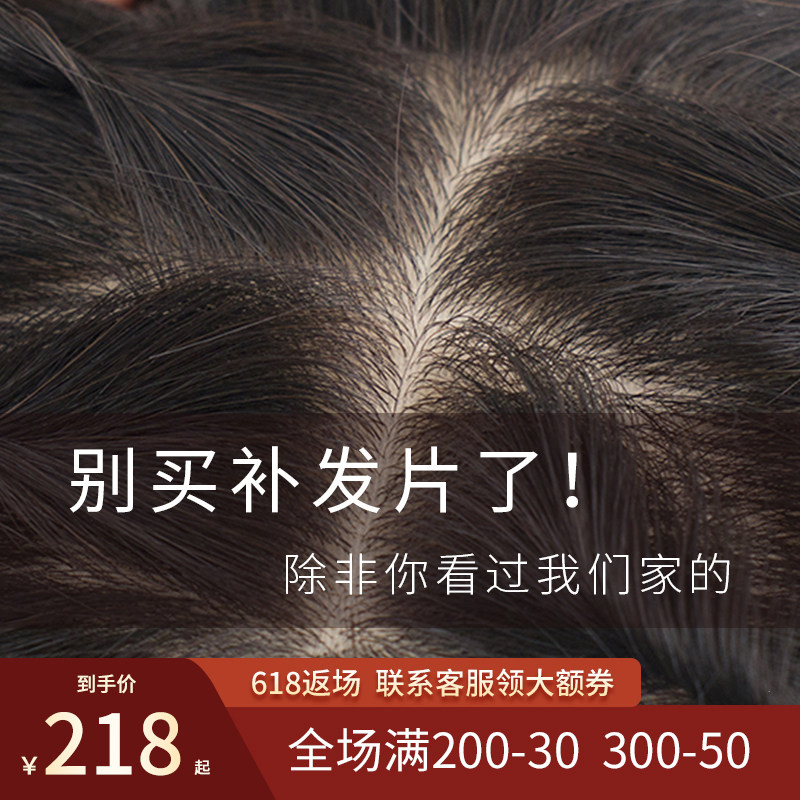 Fashion charm new needle delivery process top of head replacement piece double needle invisibility realistic mask white hair wig piece real hair