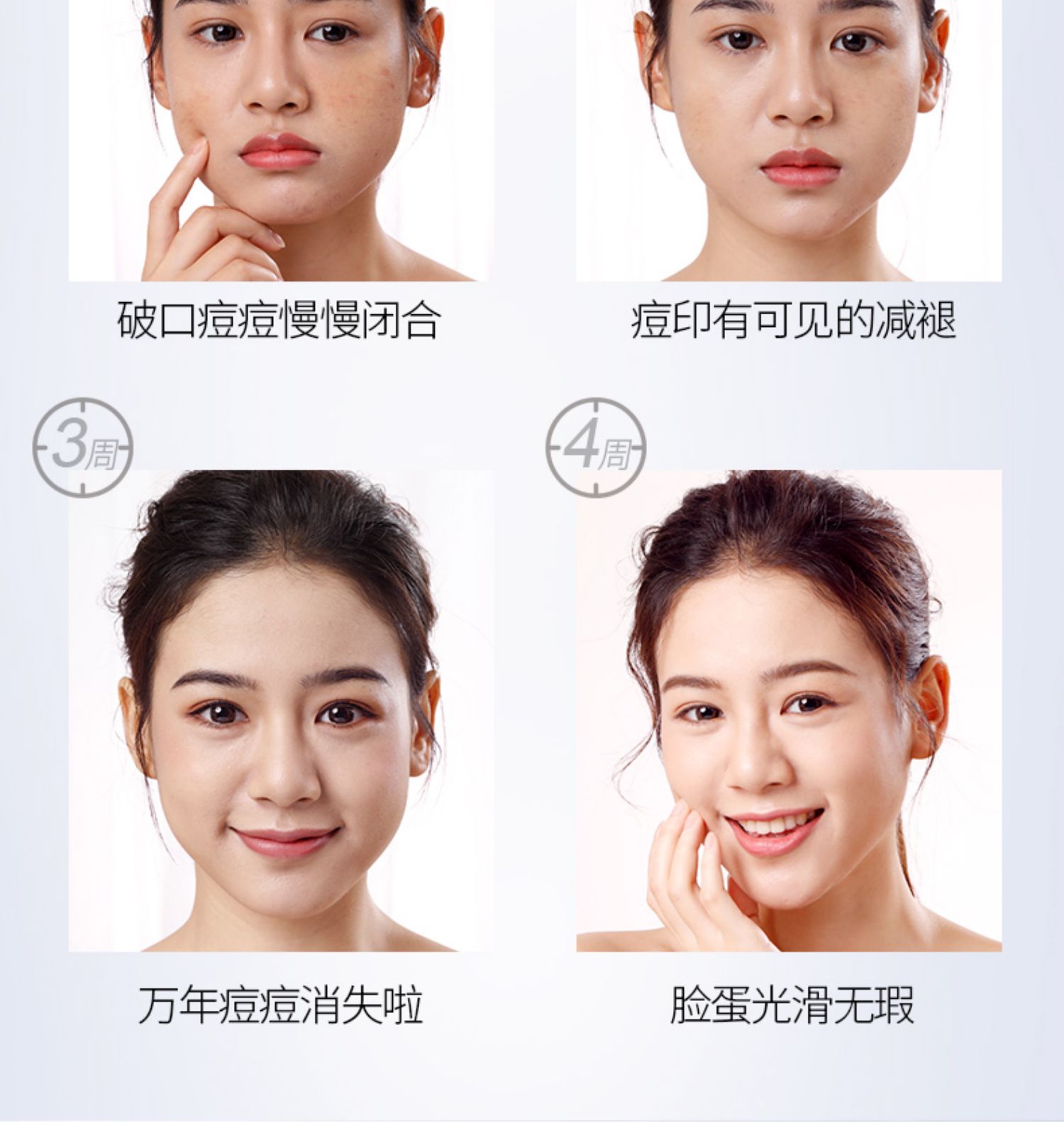 Mặt nạ mờ oligopeptide hydrat hóa mụn trứng cá mờ dần để mụn trứng cá nam giới và phụ nữ ngủ thu nhỏ lỗ chân lông - Mặt nạ mặt nạ đậu đỏ