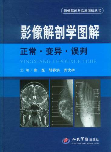 Genuine Image Anatomy Illustration · Normal · Variation · Misjudgment