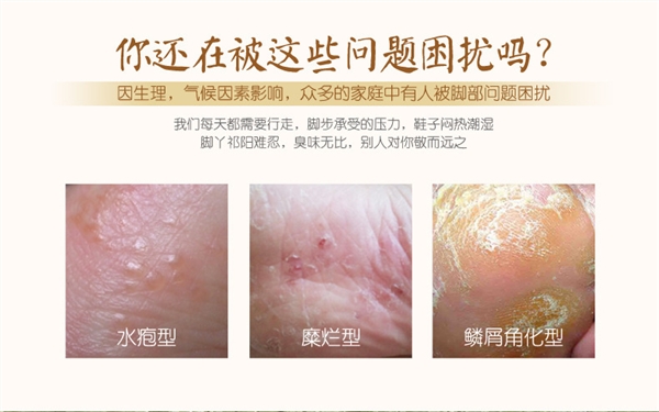 泉 雅艾 叶 泡脚 Sữa rửa mặt ngâm chân làm dịu da chăm sóc chân unisex mặt nạ chân