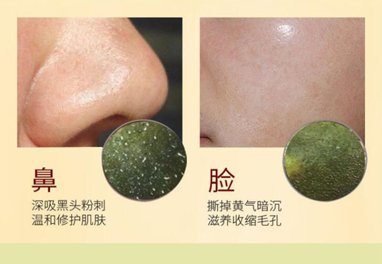 Việt Nam để mụn đầu đen mụn mặt nạ nhập khẩu chính hãng trà xanh mặt nạ bột sâu làm sạch lỗ chân lông rách nam giới và phụ nữ mặt nạ than hoạt tính