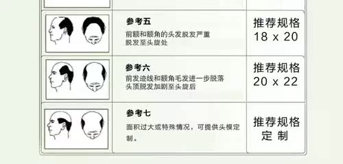 Extension cheveux - Ref 216839 Image 28