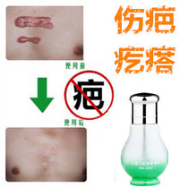 Lingsu needle repairs cesarean section scars cesarean section scars ba marks cigarette scars surgical scratches falls and canthus of the eye.