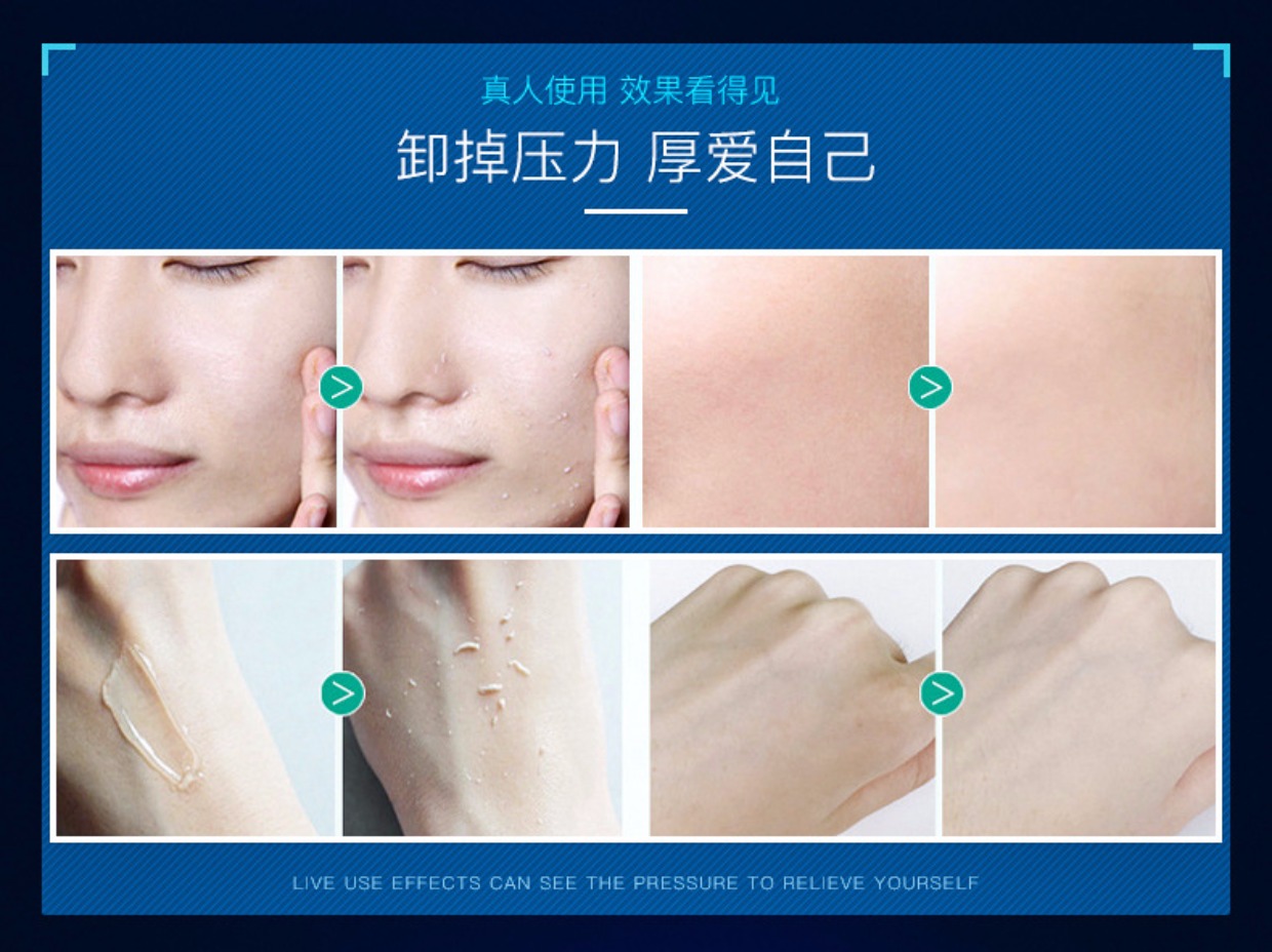 Izumi Tẩy tế bào chết cho mặt Nữ Toàn nam Gel mặt toàn thân Làm sạch sâu tẩy tế bào chết mụn đầu đen tẩy da chết aha