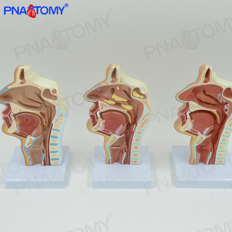 人体病理鼻腔模型口腔咽喉腔解剖鼻咽腔口咽腔 教学耳鼻喉科
