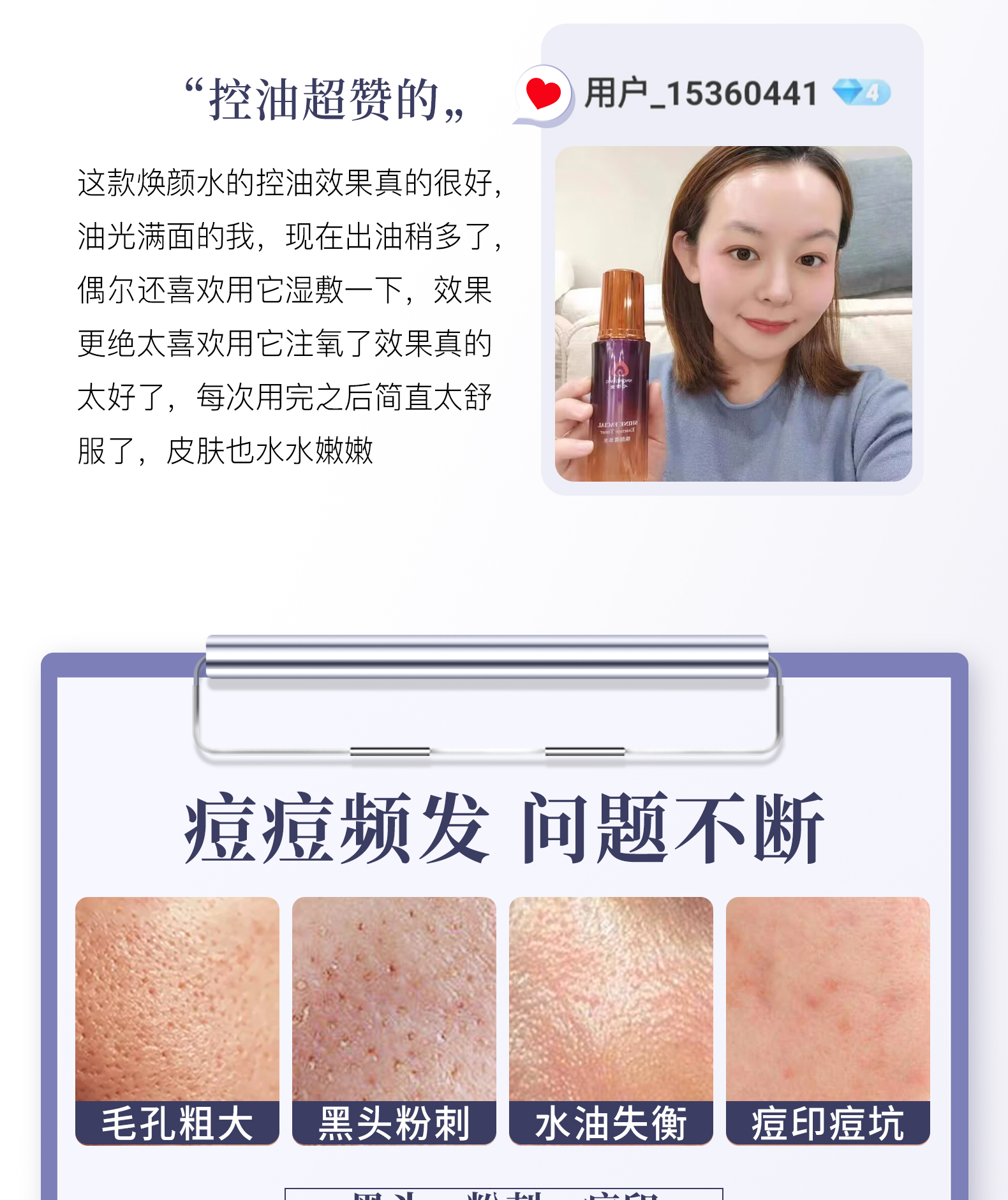 心清堂焕颜菁华水控油祛痘补水保湿爽肤水清痘净肤收缩毛孔清爽水