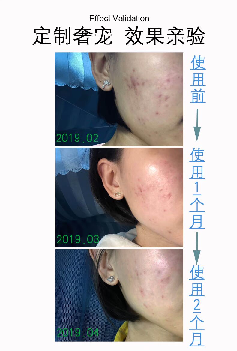 SYSS Back Light Concentrate Cream Chống lão hóa Chống lão hóa Chống nhăn Sửa chữa Dầu dưỡng ẩm Kiểm soát thay thế chai lớn màu đỏ - Kem dưỡng da dưỡng ẩm cerave