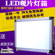 X-Ray viewing light viewing light led dental viewing light box reading light double Orthopedic