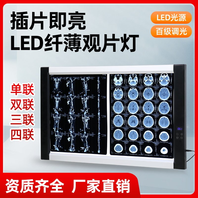 医用观片灯智能高亮调光感应阅片灯超薄led灯x光片看片灯骨科CT片