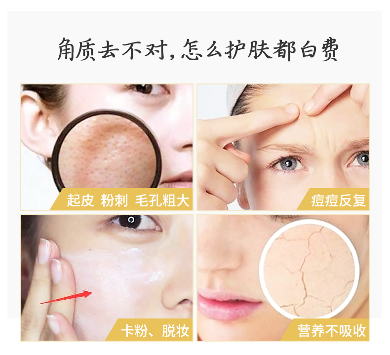 Kem tẩy tế bào chết Kem tẩy tế bào chết cho mặt Toàn thân Chăm sóc da mặt Cleanser Cleansing Pore Gel Đàn ông và phụ nữ tẩy da chết bha