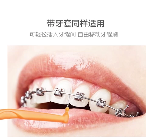 Очистите зубной зубной зазор, зубной зазор, ортодонтические скобки, ортодонтические брекеты, зубной зазор, зуб щеткой, зубной калибр, супер тонкий L -образный