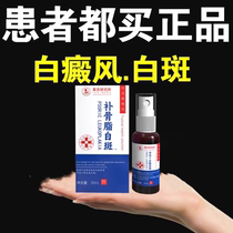 External use for vitiligo removal melanin growth-promoting plaster psoralen tincture quick elimination of white spots special sweat net