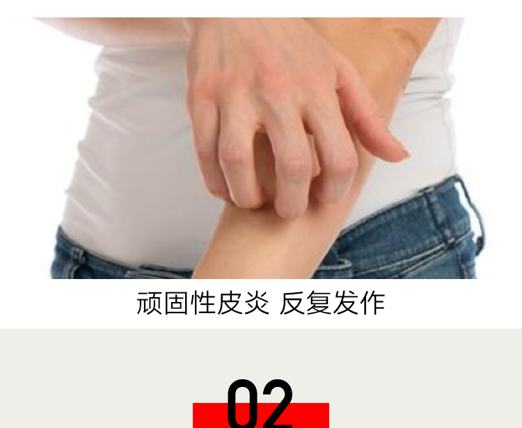 bình xịt côn trùng thái lan Man Ting Green Pepper Loại bỏ Aphid Spray Chất lỏng không diệt khuẩn Bộ đồ giường gia đình Giặt vật nuôi chống bụi - Thuốc diệt côn trùng bình xịt muỗi hiệu quả