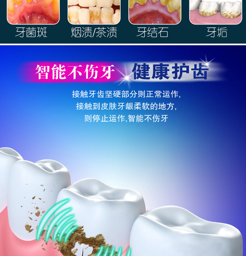 迈尔顿 充电款超声波洁牙仪 清理牙垢牙渍 图4