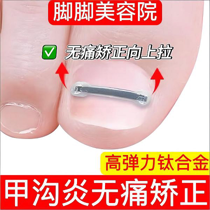 Nail Groove Ingrown Toenail Corrector Titanium Alloy Splint Special for Nail Inflammation Toenails Growing into the Flesh Nail Correction Patch Day and Night Magic Tool Nail Groove Ingrown Toenail Corrector Titanium Alloy Splint Special for Nail Inflammation Toenails Growing into the Flesh Nail Correction Patch Day and Night Magic Tool