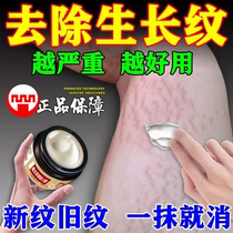 Go to obese vein growth ripples repair cream eliminates thigh student waist-abdominal upper fat veins remove male and female generic ointment