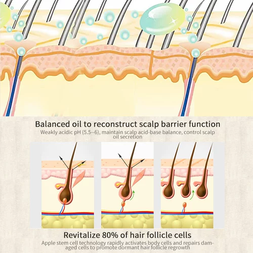 Марокканский рост волос эфирное масло эфирное масло анти -выпадение T