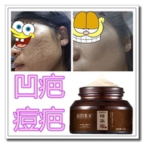 Repair pits fill in pits and scars remove pits pits and acne marks quickly regenerate and repair essence cream