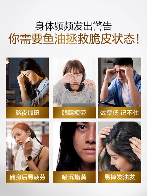 Tomson By-Health Gold Fish Oil High Purity Omega-3 Adult Dha Deep Sea Fish Oil Soft Capsules Epa