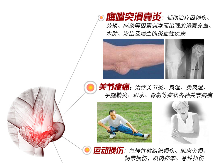 Protection sport - Ref 582108 Image 7