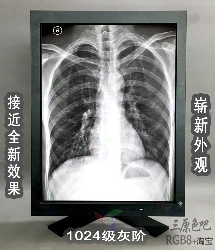 EIZO艺卓CR/DR医用显示器：医疗影像新标杆，精准诊断的利器！-娱乐办公显示器-淘宝好物网