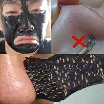 Mens anti-mite nose paste to remove acne Powerful tear-pull mask to clear pores clog pores shrink pores remove blackheads