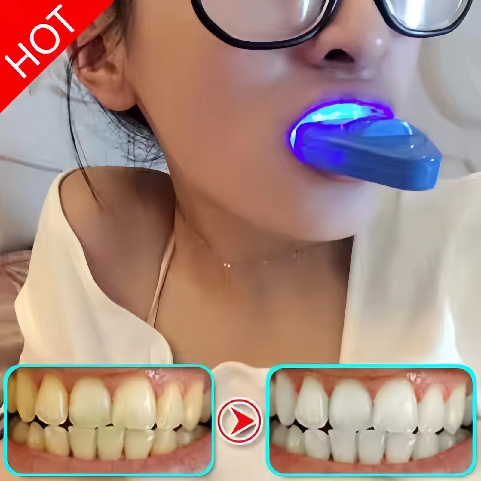 Teeth whitening quick results Go to yellow tooth smoke dental plaque Tooth Scale Black Stain Wash Tooth powder liquid tooth paste toothpaste Tooth Paste White Dentin-Taobao