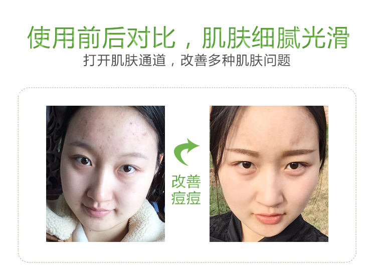 Kem massage mặt làm sạch da mặt Kem trị mụn sâu làm sạch da thu nhỏ lỗ chân lông thẩm mỹ viện thương hiệu đặc biệt - Kem massage mặt tẩy trang the face shop