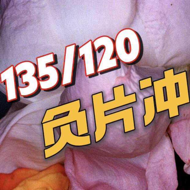 冲洗后的黑白胶片太厚？柯达配方底片如何拯救瑕疵底片