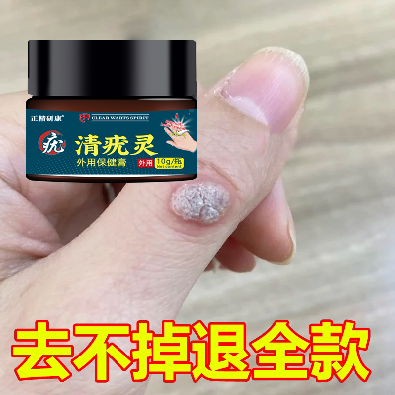 Powerful and Fast-Acting Skin Tag Remover for Hands and Feet, Genuine Product for Disinfecting and Caring for Skin Tags and Warts, External Use Ointment Powerful and Fast-Acting Skin Tag Remover for Hands and Feet, Genuine Product for Disinfecting and Caring for Skin Tags and Warts, External Use Ointment