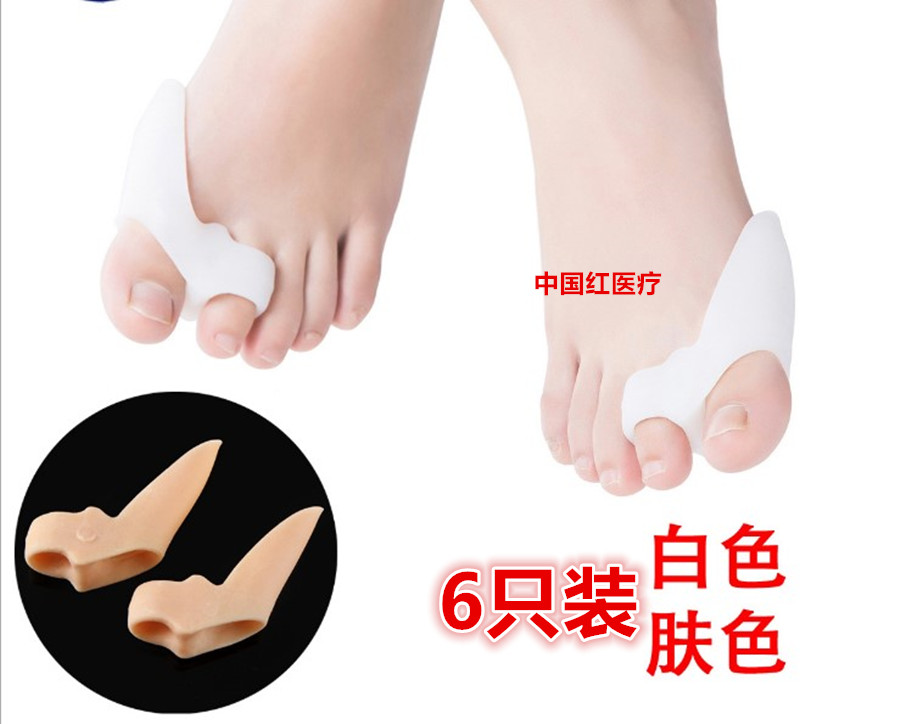 拇外翻矫正器日夜用可穿鞋拇外翻分趾器大脚骨足外翻脚趾重叠