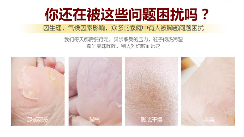 Massage chân Kem tẩy tế bào chết 180g Kem bôi chân Kem chăm sóc da chân Kem tẩy tế bào chết Unisex kem trị nứt gót