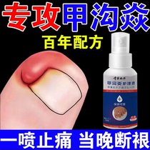 Special drug for metalloitis treatment of special drug nails to remove ointment spray from meat-based sepsis